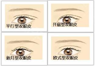 八大处整形杨欣：割了双眼皮还不好看怎么办