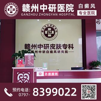 赣州白癜风医院离火车站多远 疫情期间白癜风患者怎么提高免疫力