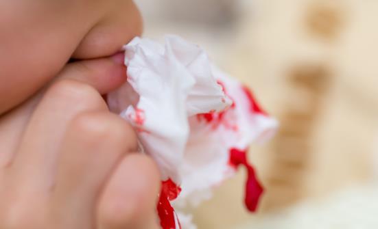 孩子老是流鼻血是什么原因 孩子流鼻血该如何处理