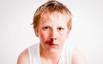 孩子老是流鼻血是什么原因 孩子流鼻血该如何处理