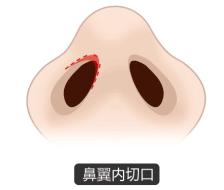 北京圣慈整形医院鼻子王王军怎么样?专业实力 让你放心美