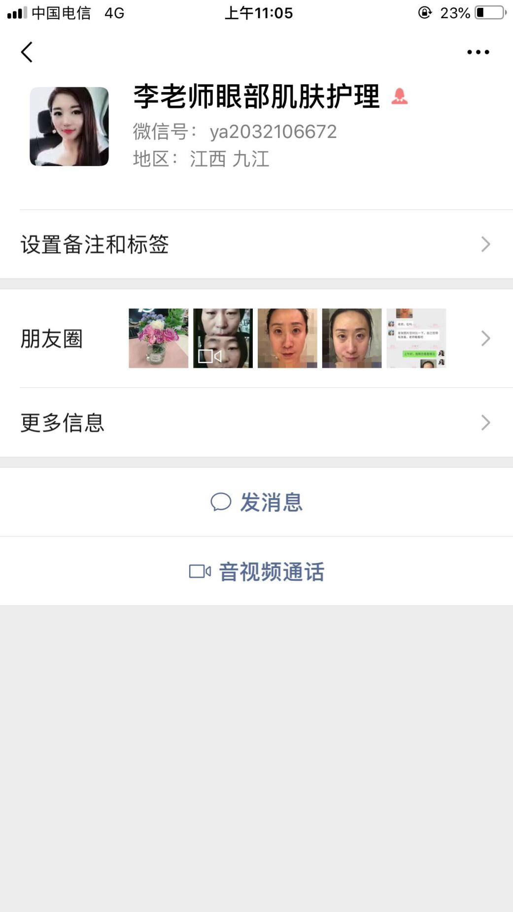 卫娅日记:我一直都以为眼袋对我的影响只是美观,直到我了解了以后……