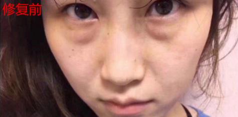 卫娅日记:我一直都以为眼袋对我的影响只是美观,直到我了解了以后……