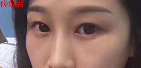 卫娅日记:我一直都以为眼袋对我的影响只是美观,直到我了解了以后……