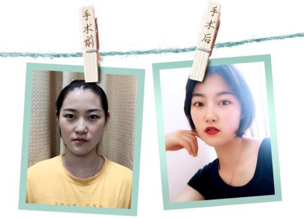 深圳恒妍整形技术如何 帮助广大女性解决多重肌肤问题