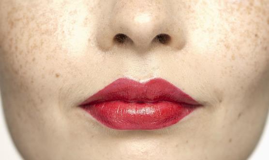 激光祛斑会不会反弹 适合激光祛斑的人群