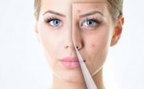 女人湿气种容易形成肥胖 排湿气注意饮食要多运动