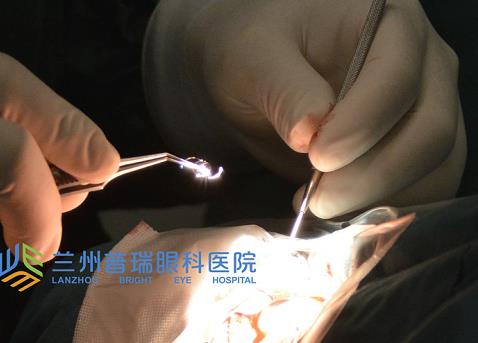 兰州普瑞眼科治疗白内障怎么样？预防白内障从年轻开始