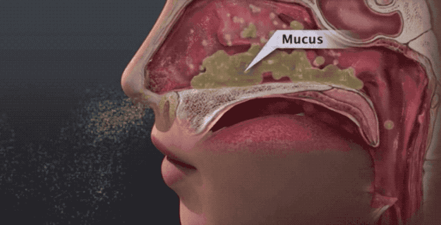 春季鼻敏感，儿科专家鲍秀兰给大家支招！