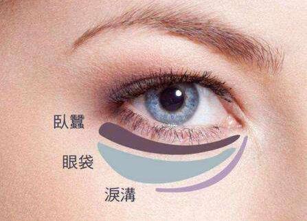 八大处整形杨欣帮你讲解:眼袋祛除后过几年还会复发吗?