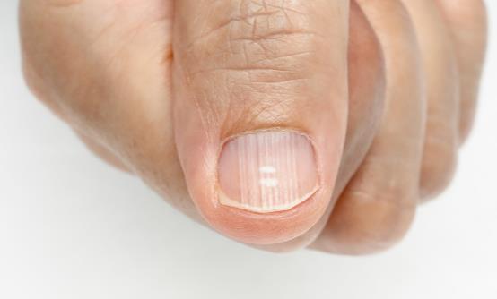 指甲颐养也是一门学问 若何处置指甲概况不但滑的情形