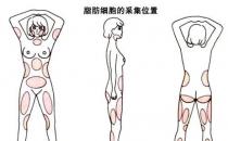 韦元强：产后能做自体脂肪丰胸吗？