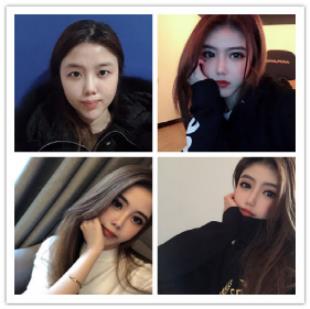 巧致26周年庆典经典项目-巧致五维魅眼形成术