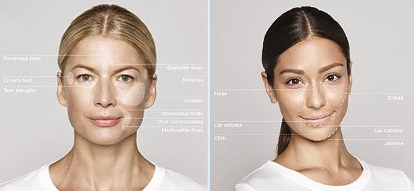 常州曙光美容医院做眼部整形怎么样 安全自然定制美丽