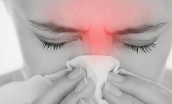 过敏性鼻炎容易反复 缓解鼻炎症状的10种小偏方