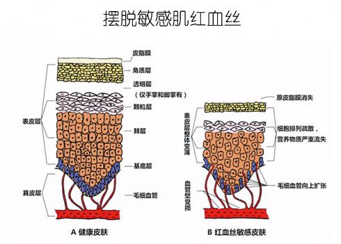 放心!有美薏升修复敏感肌红血丝专家产品在,你每天都可以美美哒