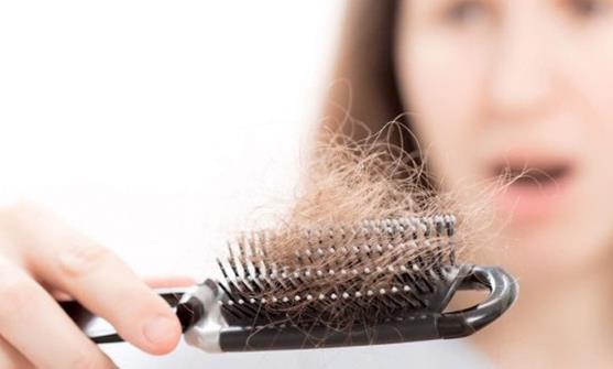 导致女性掉发的6个原因