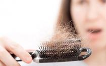 ​导致女性掉发的6个原因 做好防辐射工作预防掉发