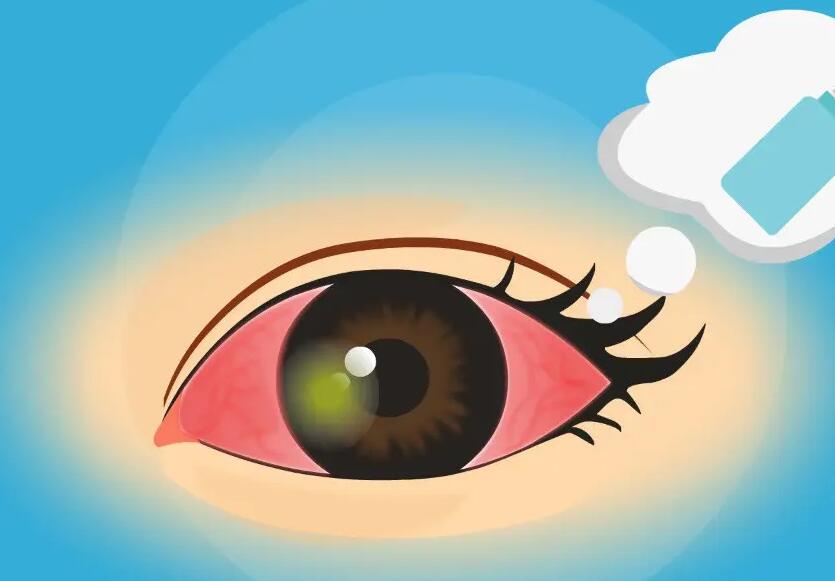 眼球发红充血怎么回事，眼球发红充血怎么回事怎么治疗