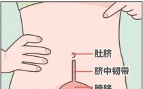 肚脐下面疼是怎么回事，肚脐下面疼是怎么回事男性